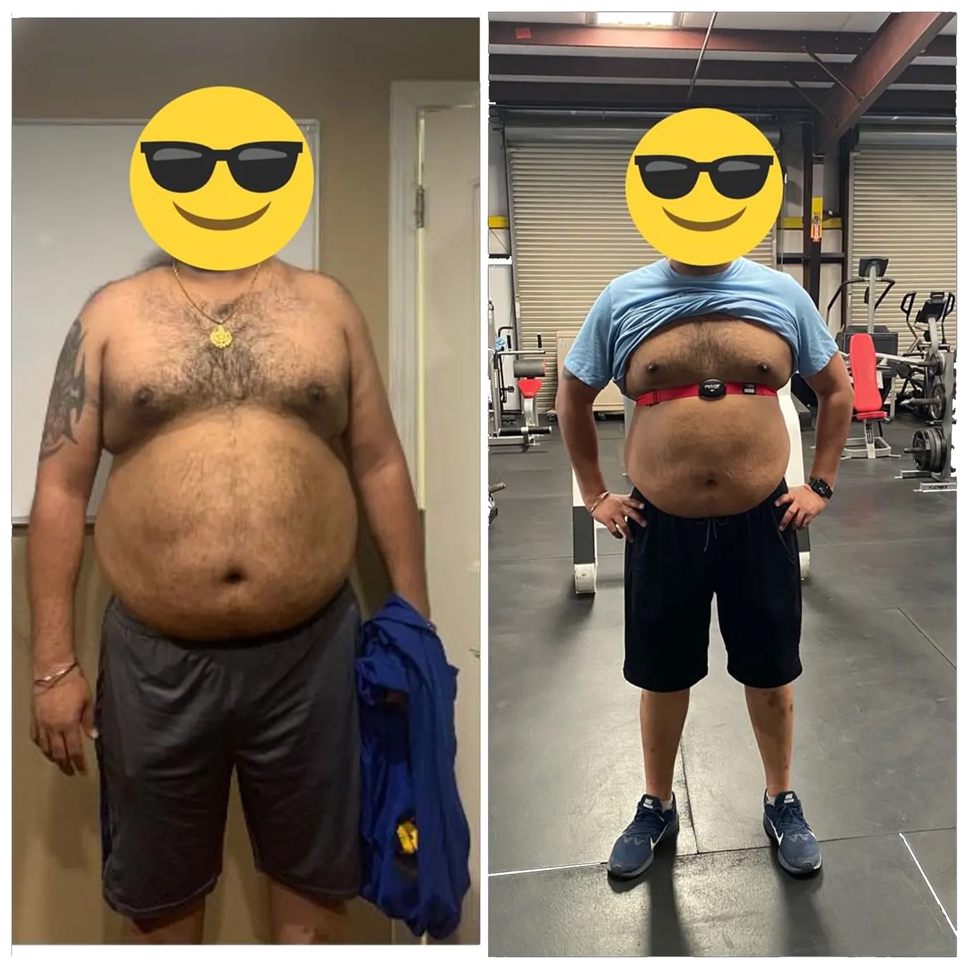 Side-by-side before and after photos of a client with an emoji covering the face.