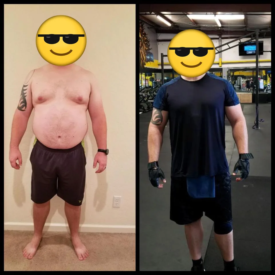 Client before and after, front view, face covered.