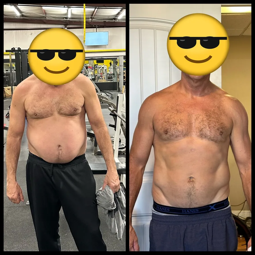 Client before and after, front view, face covered.