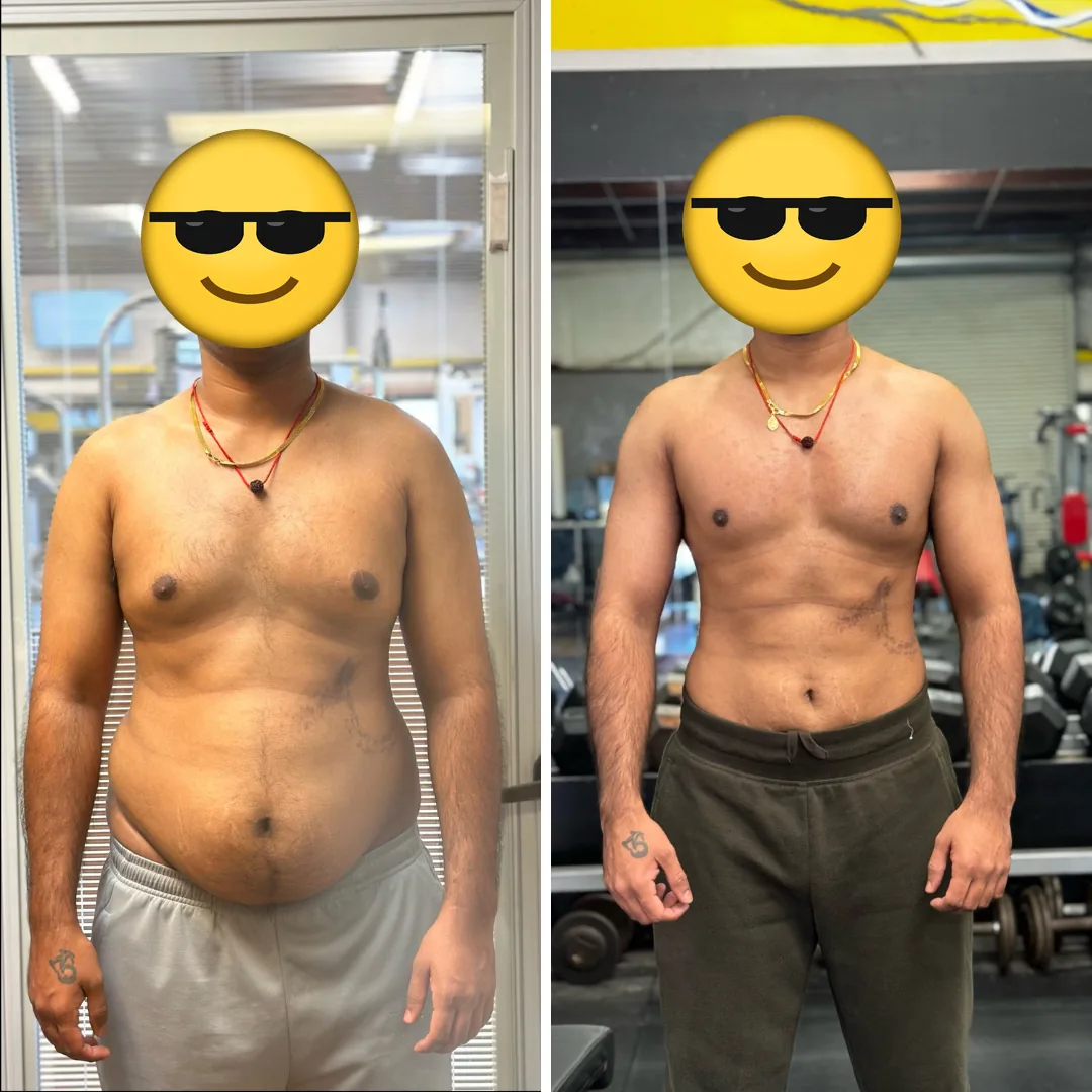 Client before and after, front view, face covered.
