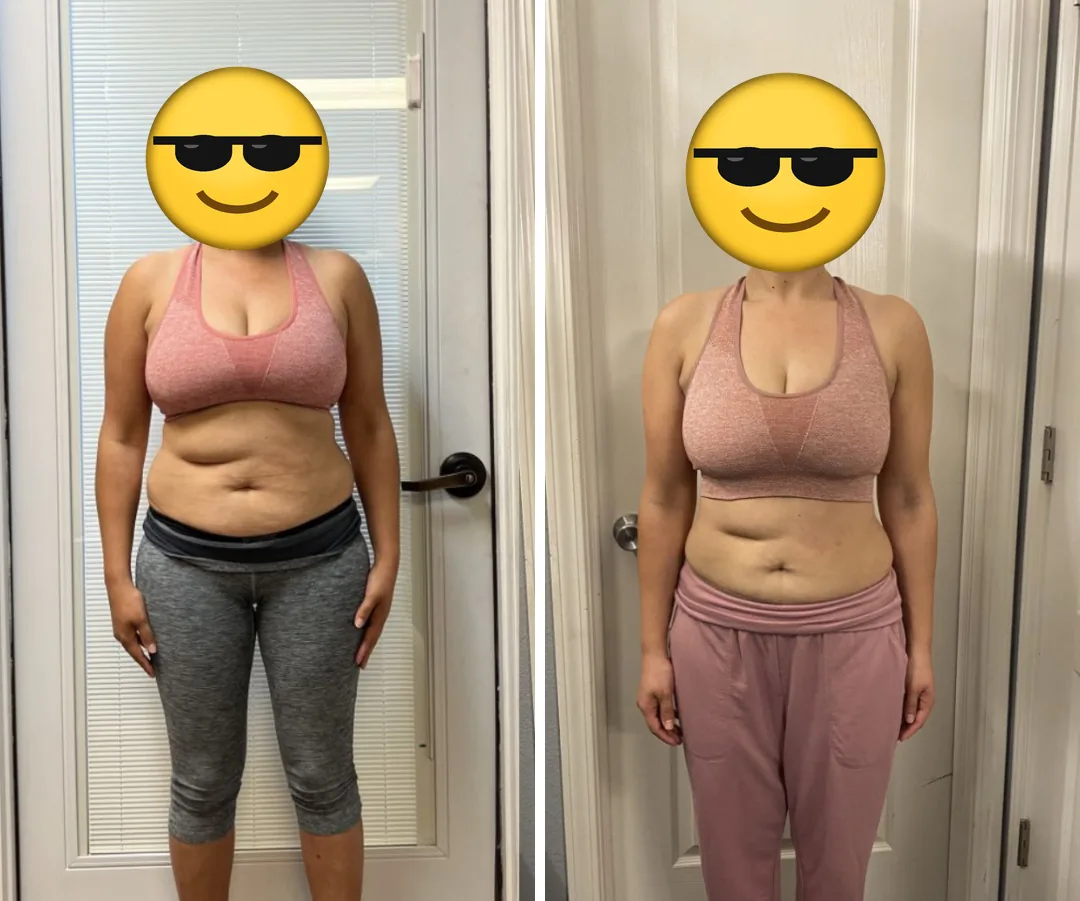 Client before and after, front view, face covered.