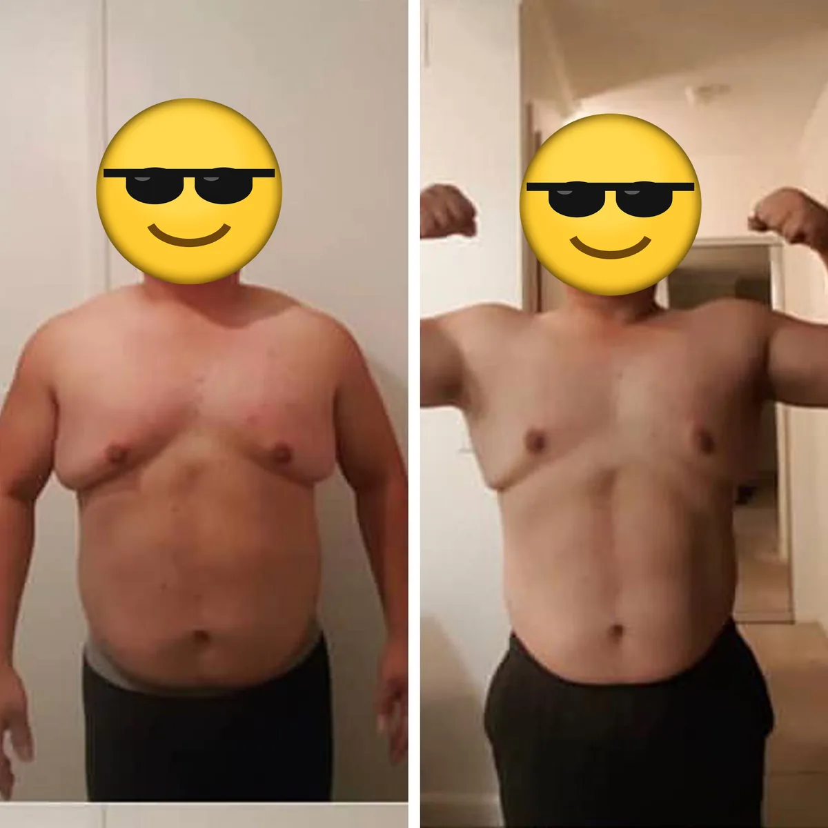Front view before and after photos of a client, face covered with an emoji.