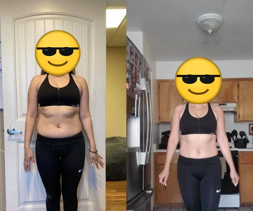 Front view before and after photos of a client, face covered with an emoji.