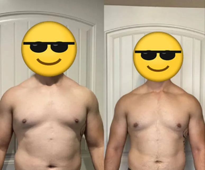 Front view before and after photos of a client, face covered with an emoji.